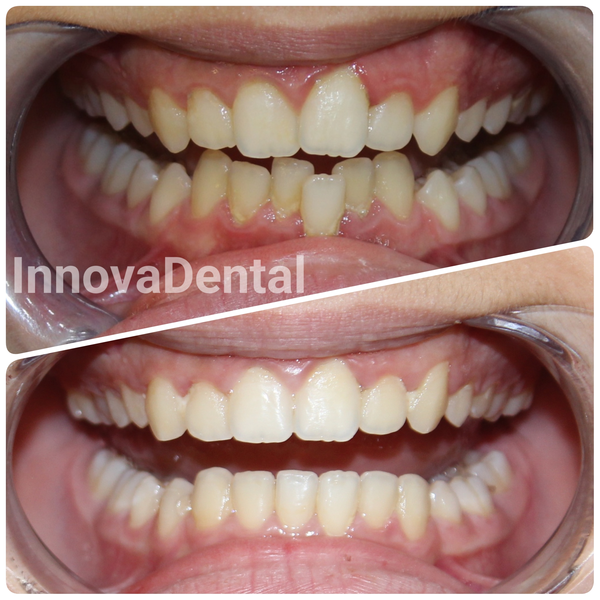 orthodontics