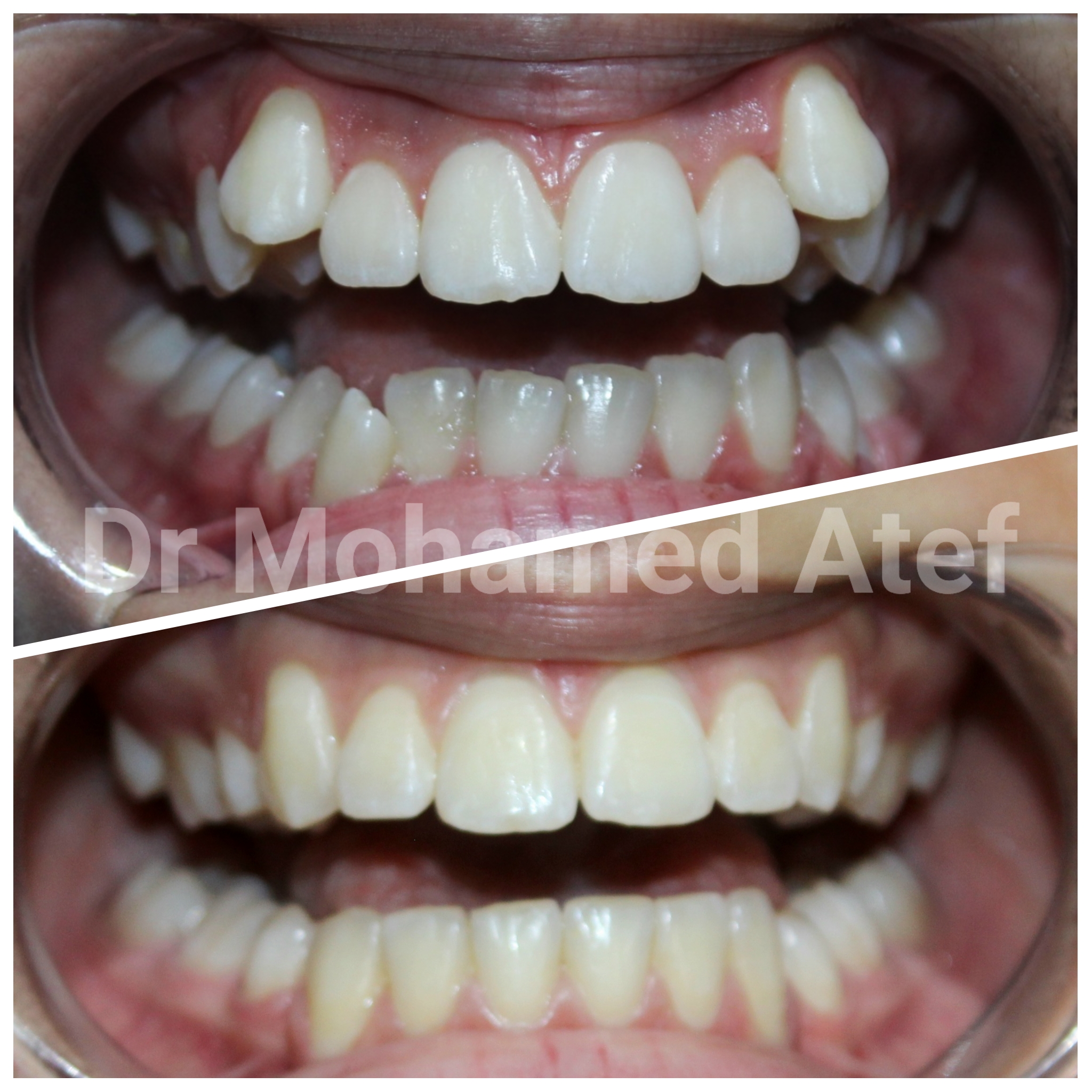 orthodontics
