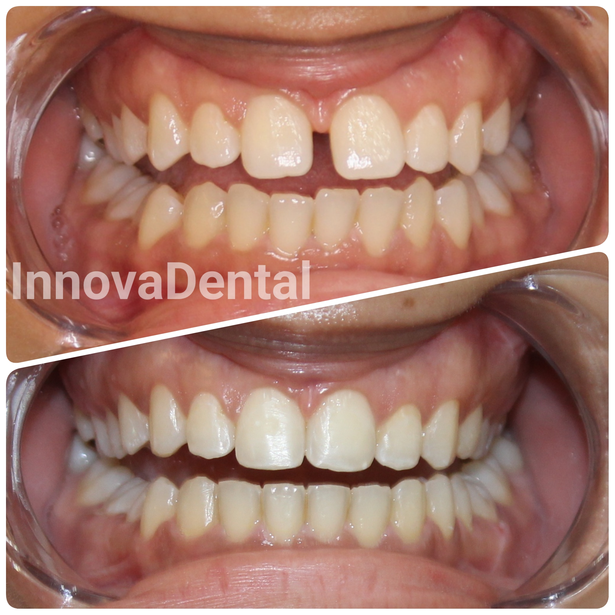 orthodontics